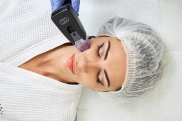 Микроигольчатый RF-лифтинг